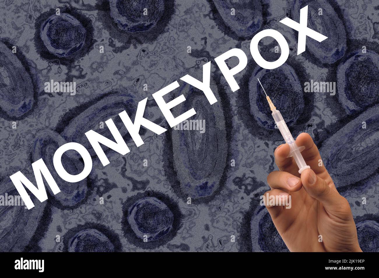 Monkeypox Injection Hand with injection needle on a monkeypox virus background Stock Photo ...