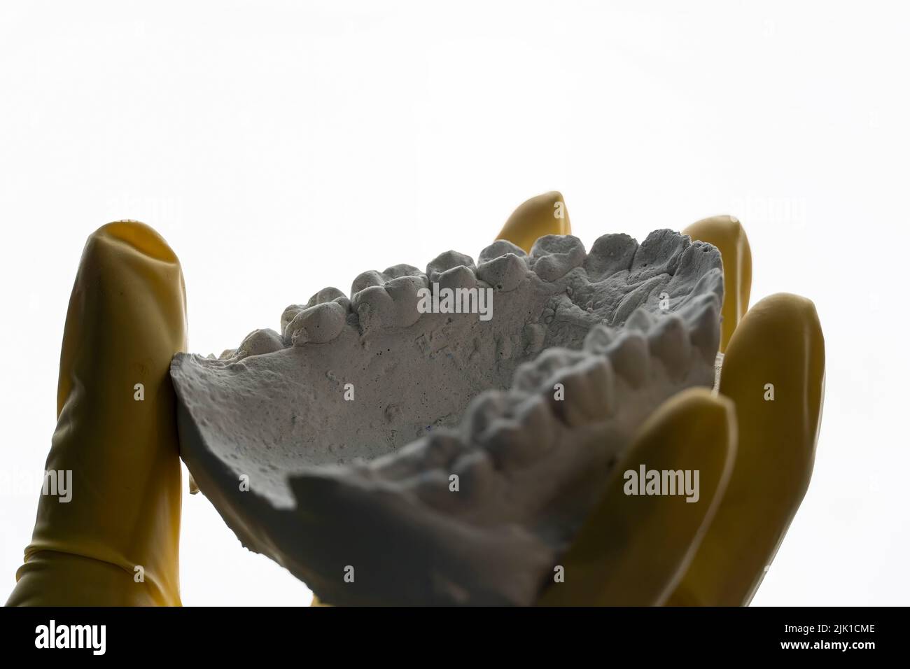 showing the patient a plaster mouth, taken from an impression Stock