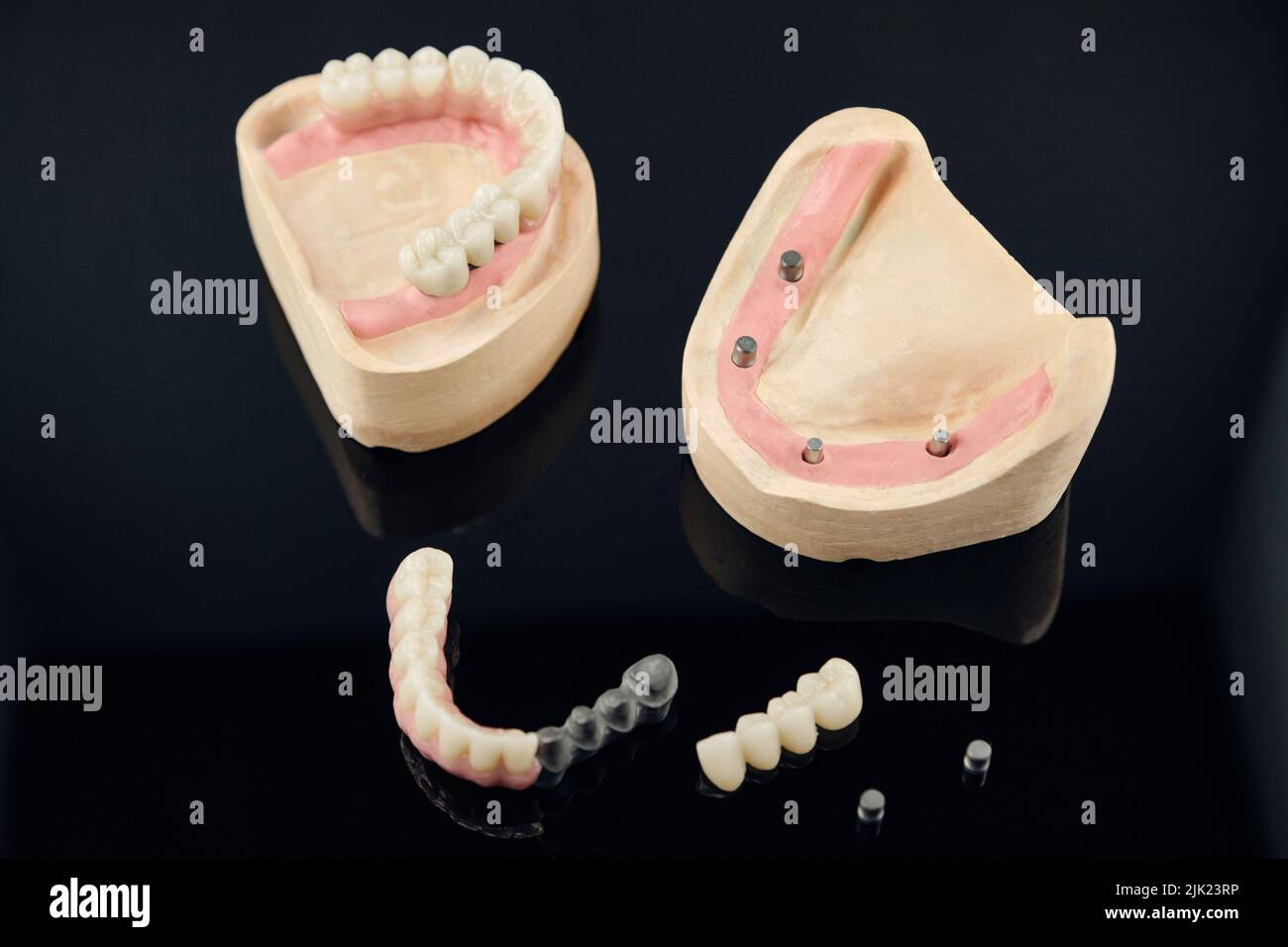 Composition of dental crowns and orthopedic components on a black background. Zirconia Full