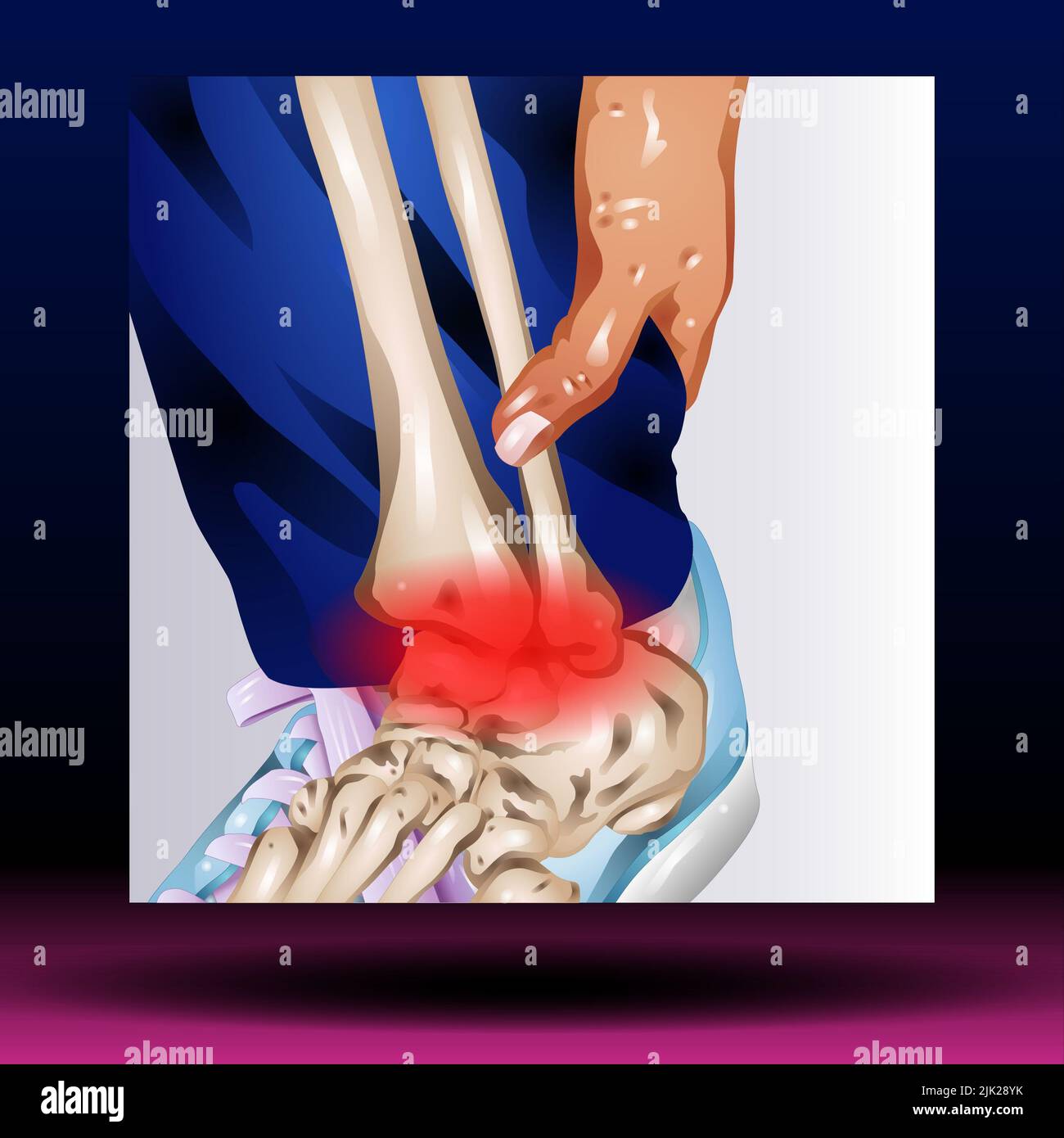 Anterior Longitudinal Ligament - Body Parts - Spine - Skeleton - Medical - Graphic - Joint Stock Photo