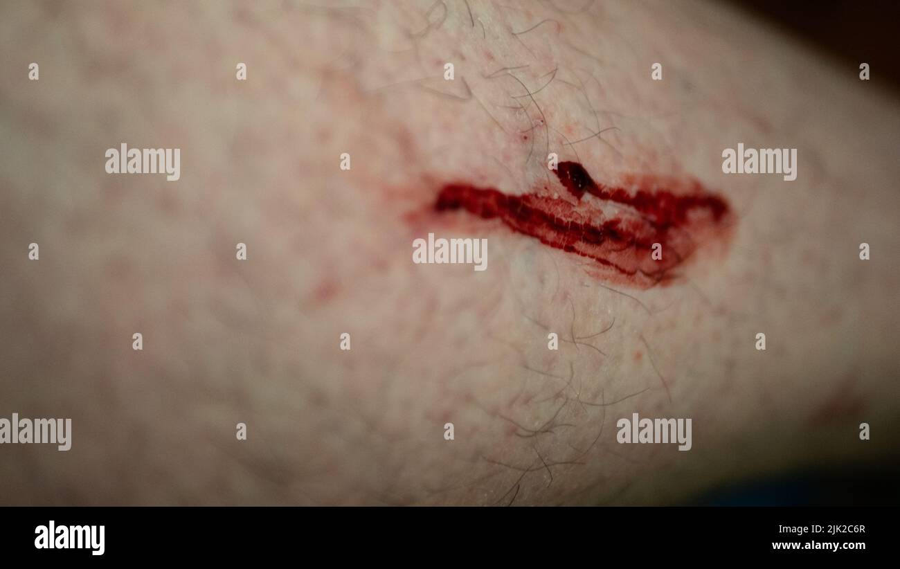 blood flowing from the leg, close up Stock Photo