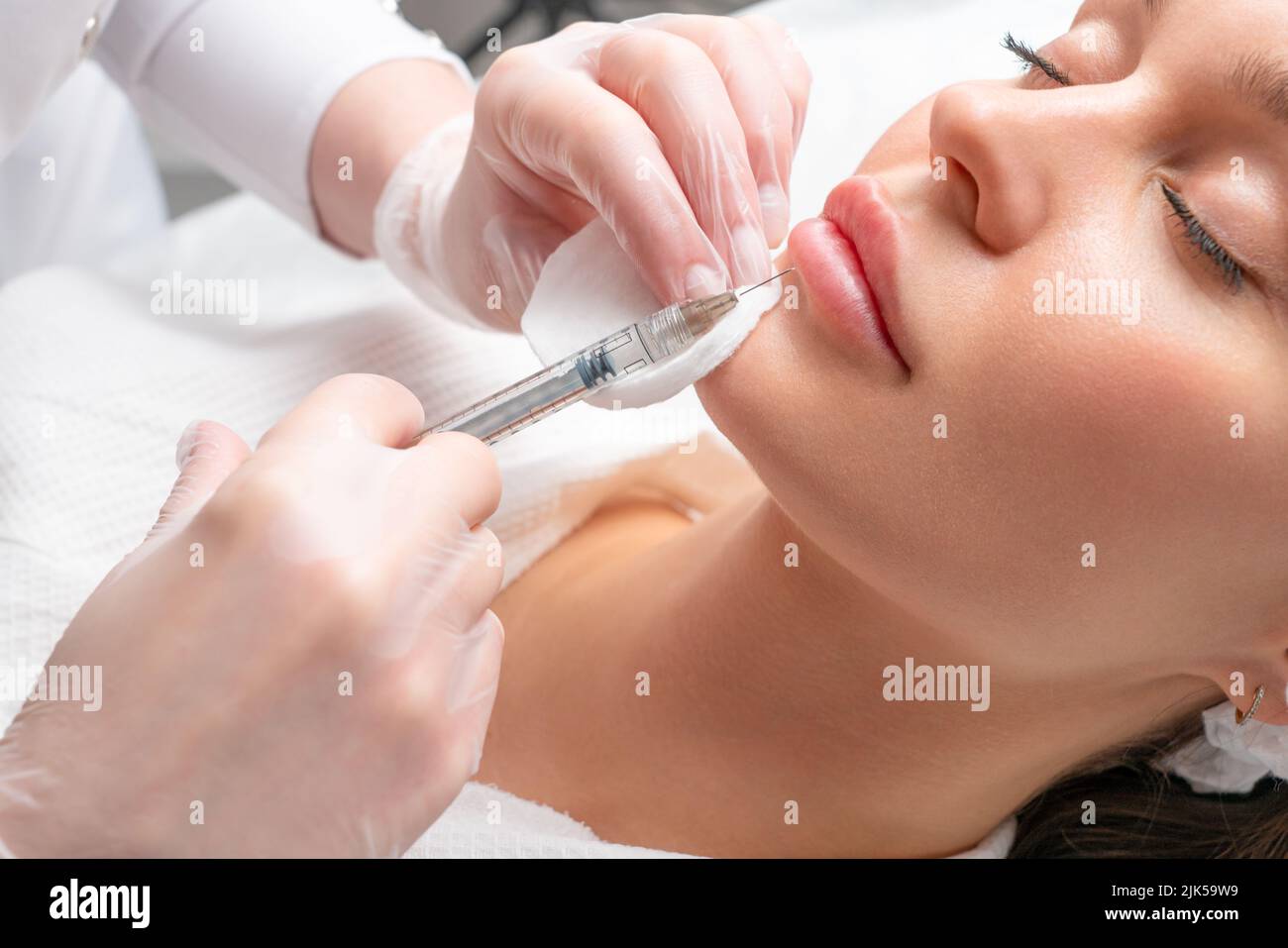 Lip augmentation and correction procedure in a cosmetology salon. The specialist makes an injection in the patient's lips. Stock Photo