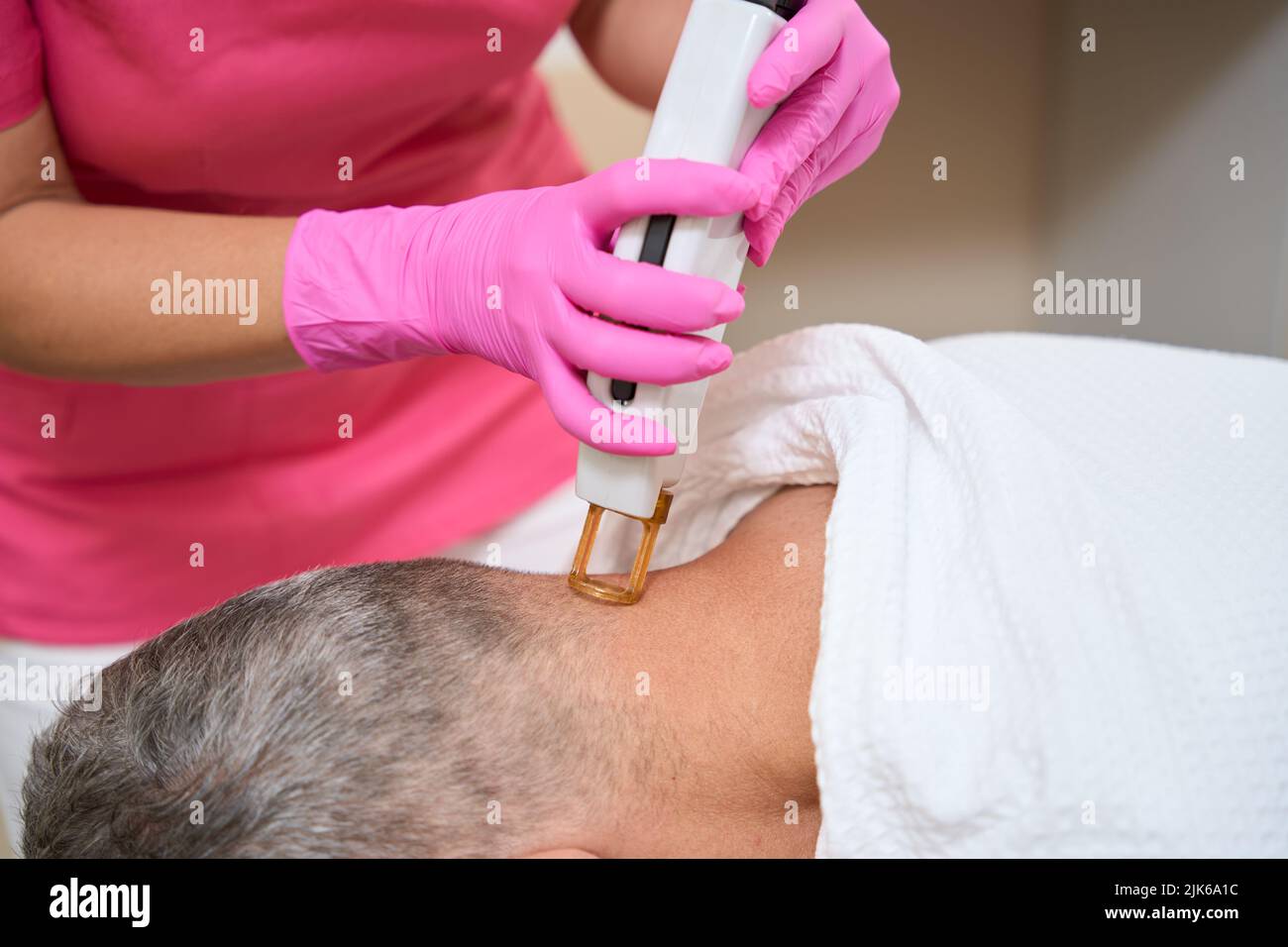 Laser hair removal on back of head of man Stock Photo Alamy