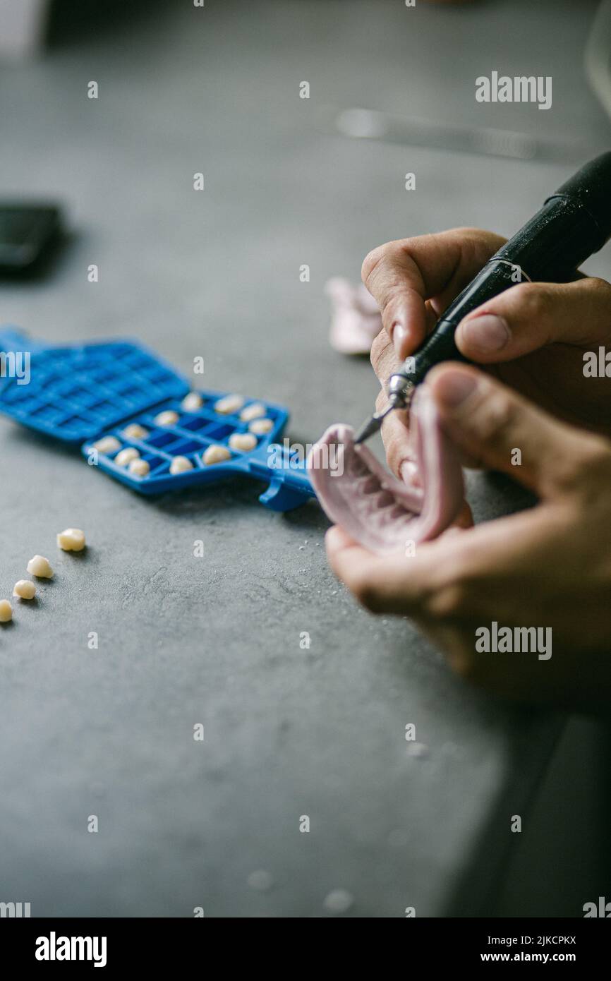 mechanical retention for adhesion of resin of dental prosthesis Stock