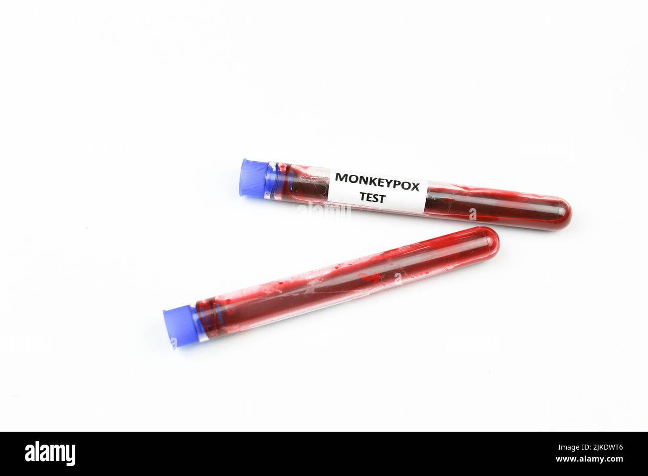 Test tubes filled with blood for Monkeypox on white background Stock ...