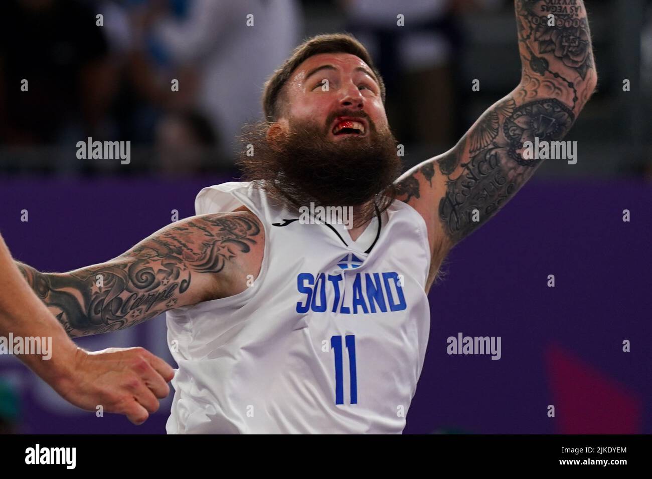 Scotland's Gareth Murray bleeds from his mouth during the men's semi