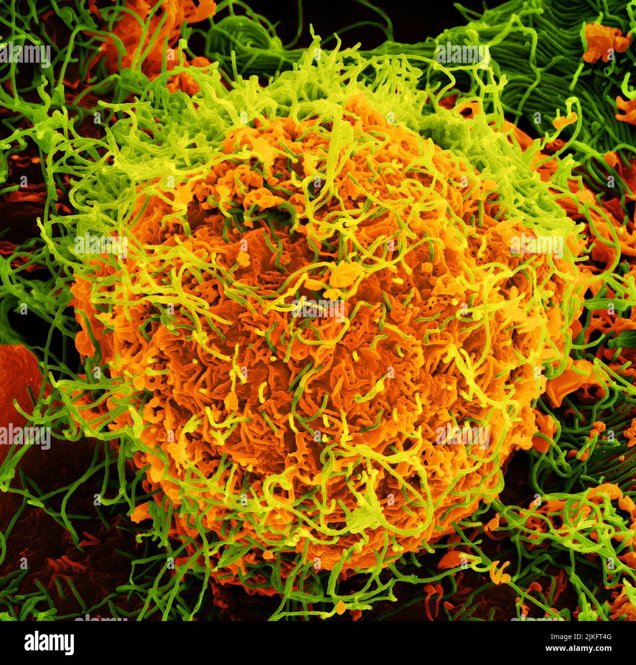 Scanning electron micrograph of Ebola virus particles (green) budding and attached to the surface of infected VERO E6 cells (orange). Focused image at the NIAID Integrated Research Center in Fort Detrick, Maryland. Credit: NIAID Stock Photo