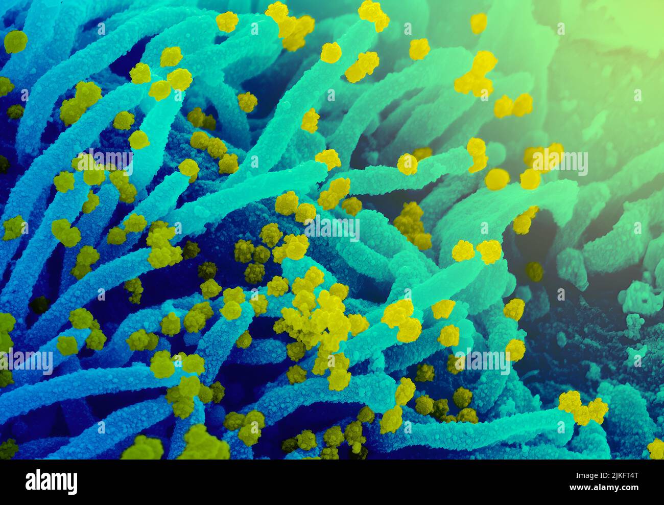 This scanning electron microscope image shows SARS-CoV-2 (round yellow particles) emerging from the surface of a cell cultured in the laboratory. SARS Stock Photo
