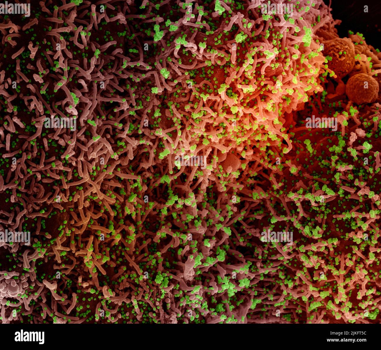 Colorized scanning electron micrograph of a cell infected with a variant strain of SARS-CoV-2 virus particles, isolated from a patient sample. Image requested from the NIAID Integrated Research Facility (IRF) in Fort Detrick, Maryland. Credit: NIAID Stock Photo