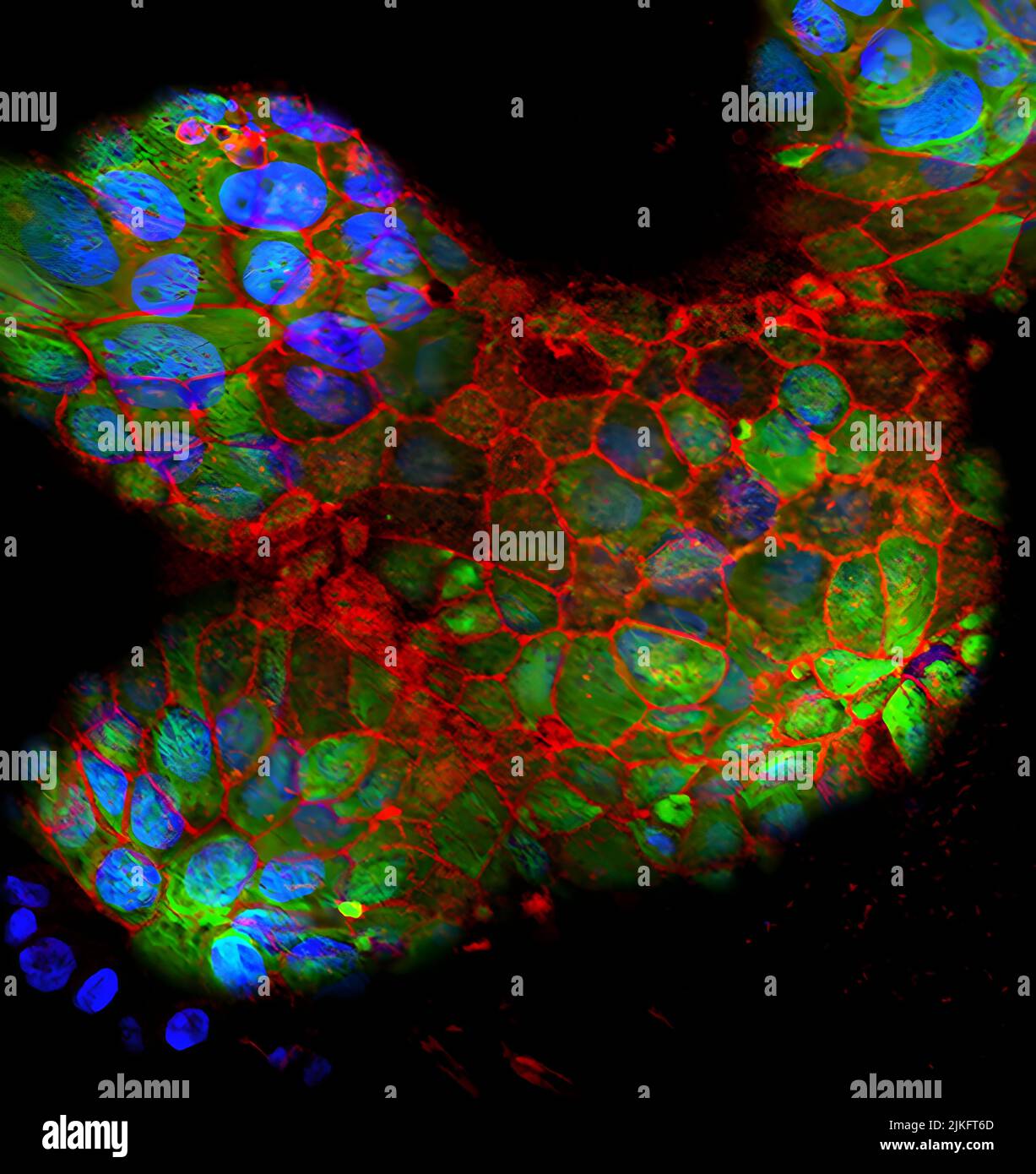Three pearls covered with placental cells (marked in green). Nuclei are blue and cell junctions are red. Stock Photo