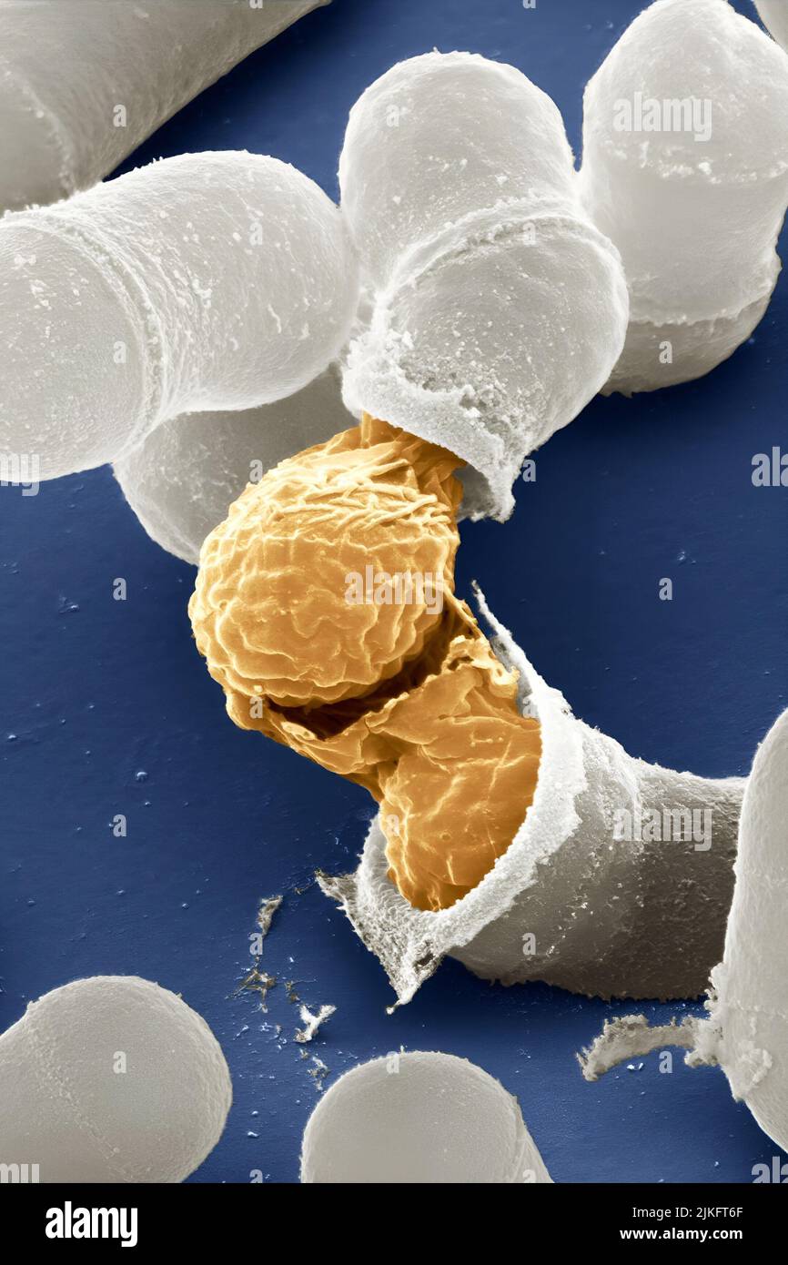 Yeast makes bread, beer and wine. And like us, yeast can reproduce sexually. A mother and father cell merges and a large cell which contains four offspring. When environmental conditions are favorable, the offspring are released, as shown here. Yeasts are also a popular subject of study for scientists. Yeast research has yielded vast knowledge of basic cellular and molecular biology as well as a myriad of human diseases, including colon cancer and various metabolic disorders. Stock Photo