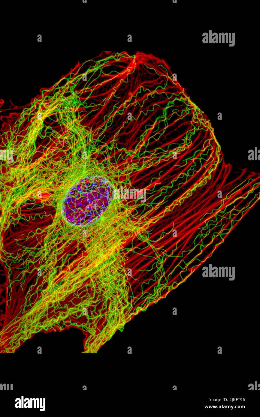 This image shows a normal fibroblast, a cell type common in connective tissue and frequently examined in research laboratories. Unlike the spiky version, this cell has a healthy skeleton composed of actin (red) and microtubules (green). Actin fibers contain like muscles to create tension and microtubules contain like bones to resist compression. Stock Photo