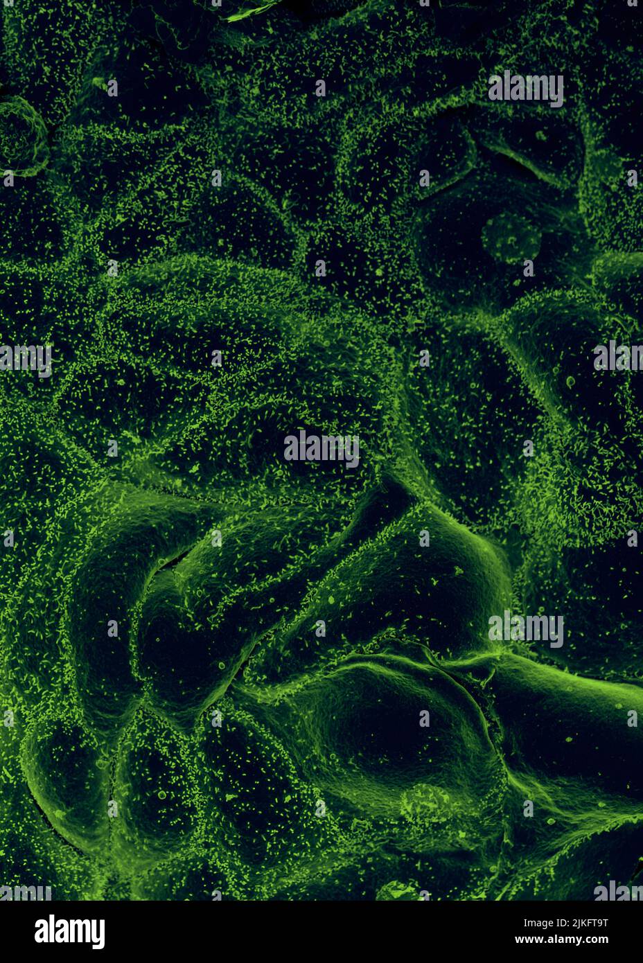 Ebola virus isolated in November 2014 from patient blood samples obtained in Mali. The virus was isolated on Vero cells. Stock Photo