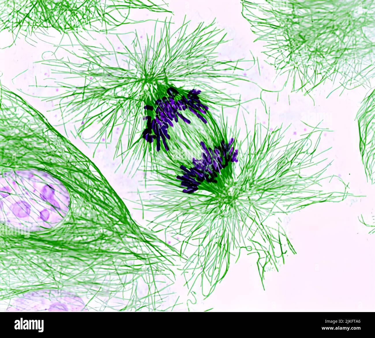 This pig cell is dividing. The chromosomes (purple) have already replicated and the duplicates are separated by fibers in the cell skeleton called microtubules (green). Cell division studies provide essential knowledge to advance the understanding of many human diseases, including cancer and birth defects. Stock Photo