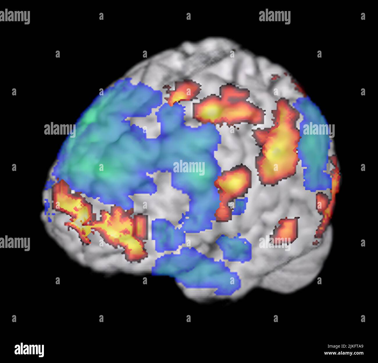 In February 2008, NIDCD researchers reported that they had used functional MRI to study the brains of musicians playing improvised jazz. The images revealed that a large region of the brain involved in monitoring one's performance shuts down during creative improvisation, while a small region involved in organizing self-initiated thoughts and behaviors is strongly activated. Stock Photo