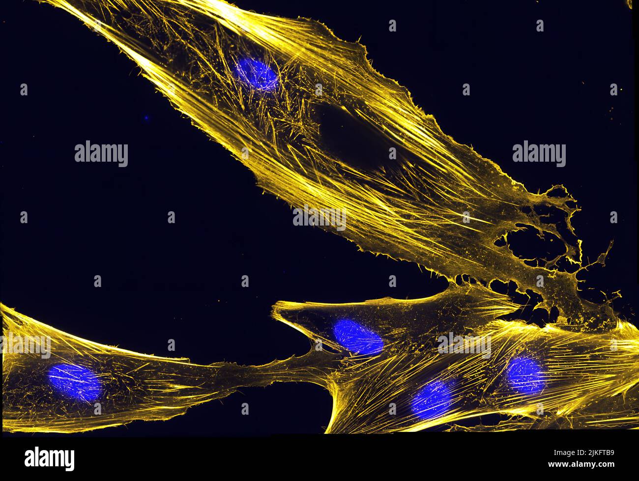 Immunofluorescence image of actin bundles in muscle precursor cells called myoblasts. Actin is labeled with fluorescently labeled phalloidin, which is a toxin from the fungus Amanita phalloides. Nuclei are shown in blue. Stock Photo
