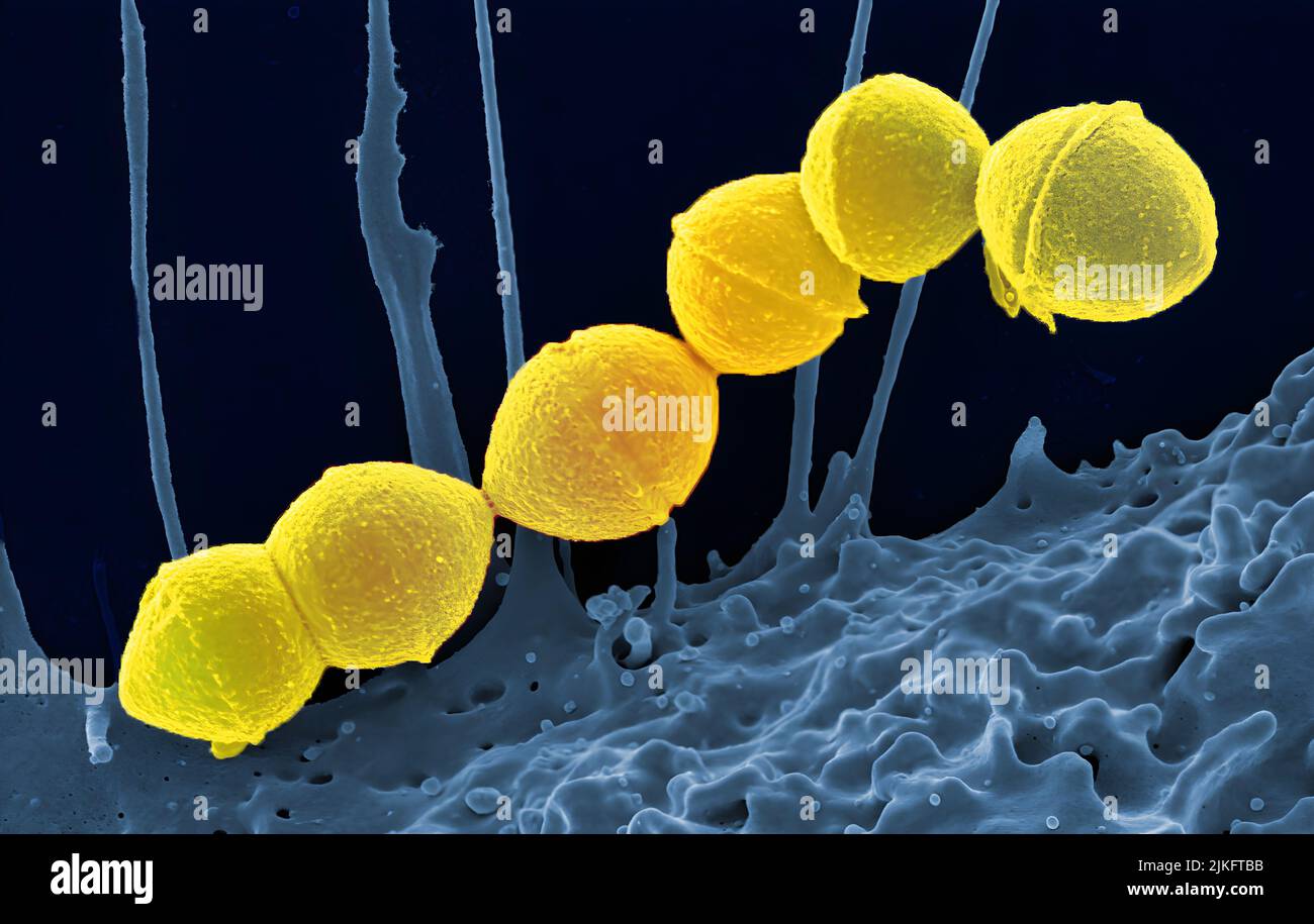 Image of group A streptococcus bacteria. Stock Photo