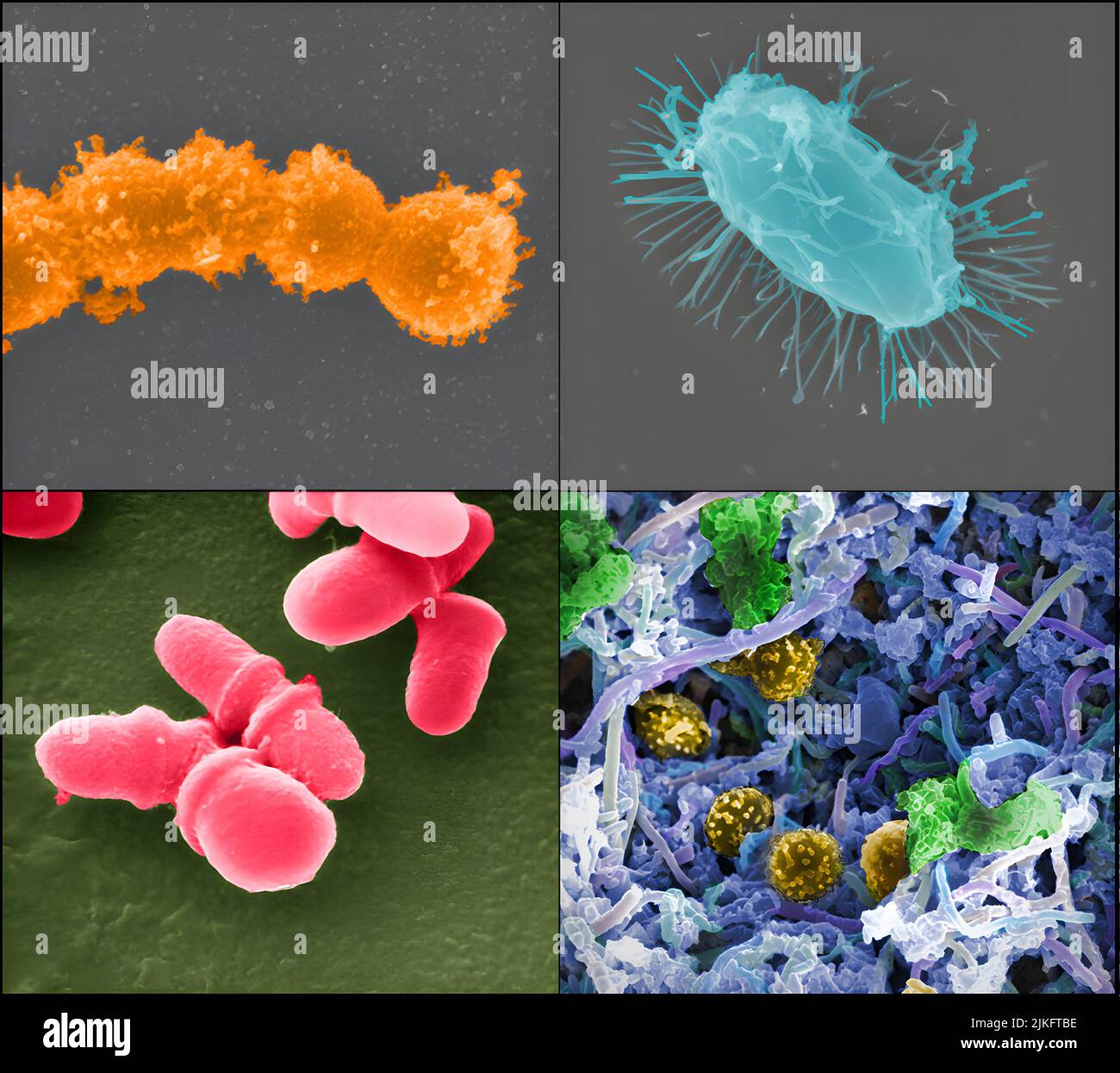 The Human Microbiome Project, which was launched by the NIH in 2007, provided the first insight into the microbial life of healthy humans and explores possible relationships between particular human diseases and the microbiome. (Clockwise from top left): Streptococcus (Credit: Tom Schmidt) Mixed species microbial biofilm, from the human body (Credit: A. Earl, Broad Institute/MIT) Bacillus (Credit : Tom Schmidt) Malassezia lopophilis (Credit: JH Carr, CDC). Stock Photo
