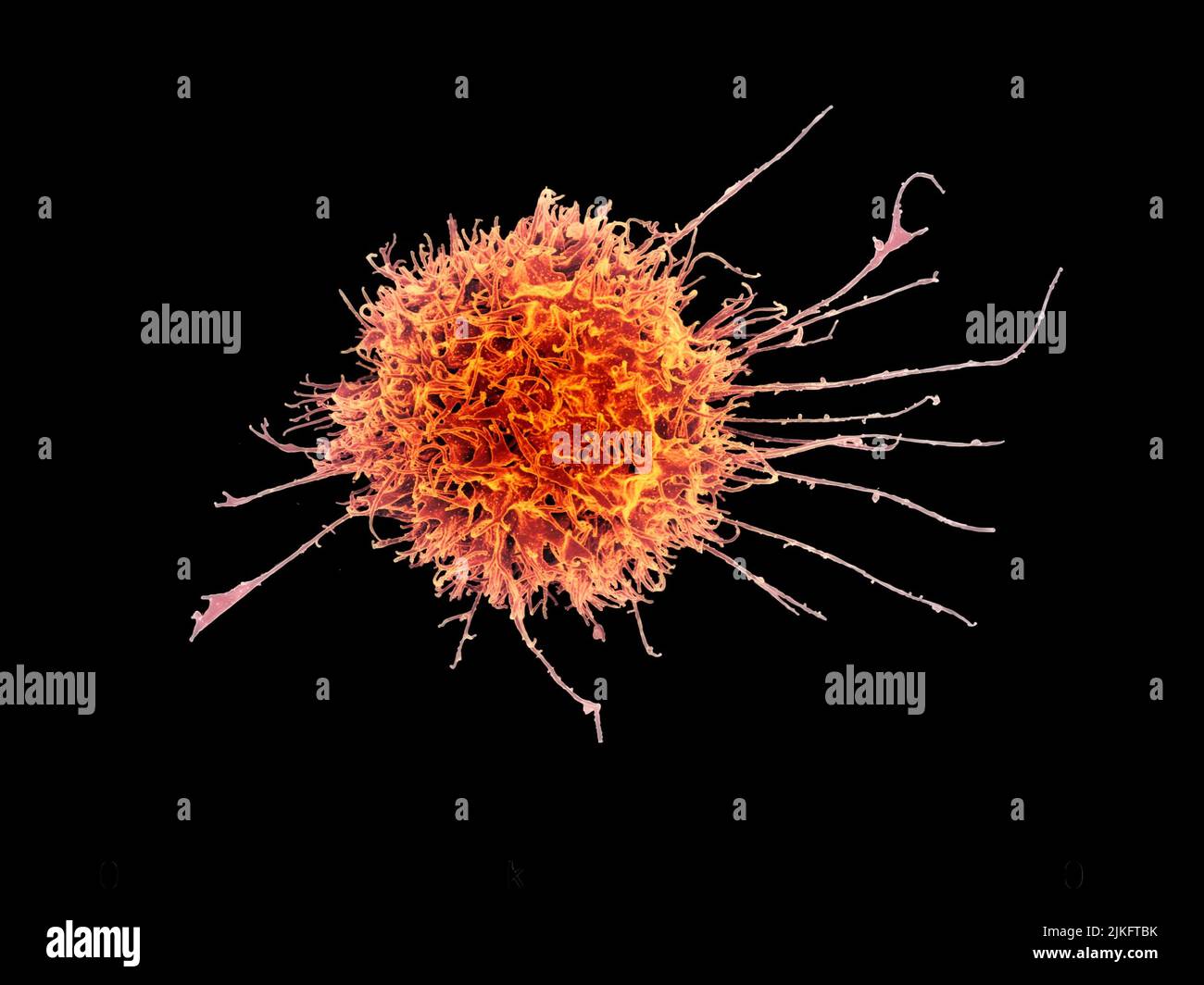 Colorized scanning electron micrograph of a natural killer cell from a human donor. Stock Photo