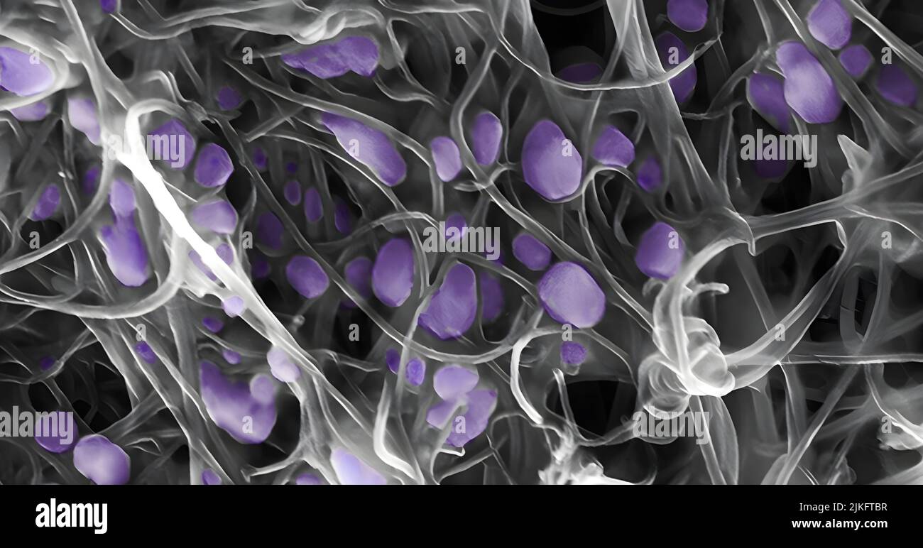 The purple pods you see in this scanning electron micrograph are the H5N2 avian influenza virus, an averted threat to the poultry and egg industry and, in very rare cases, a risk to human health. However, these particular pods are unlikely to infect anything as they are trapped in a gray mesh of carbon nanotubes. Made by hanging carbon atoms in a cylindrical pattern, these nanotubes are about 10,000 times smaller than the width of a human hair. Stock Photo