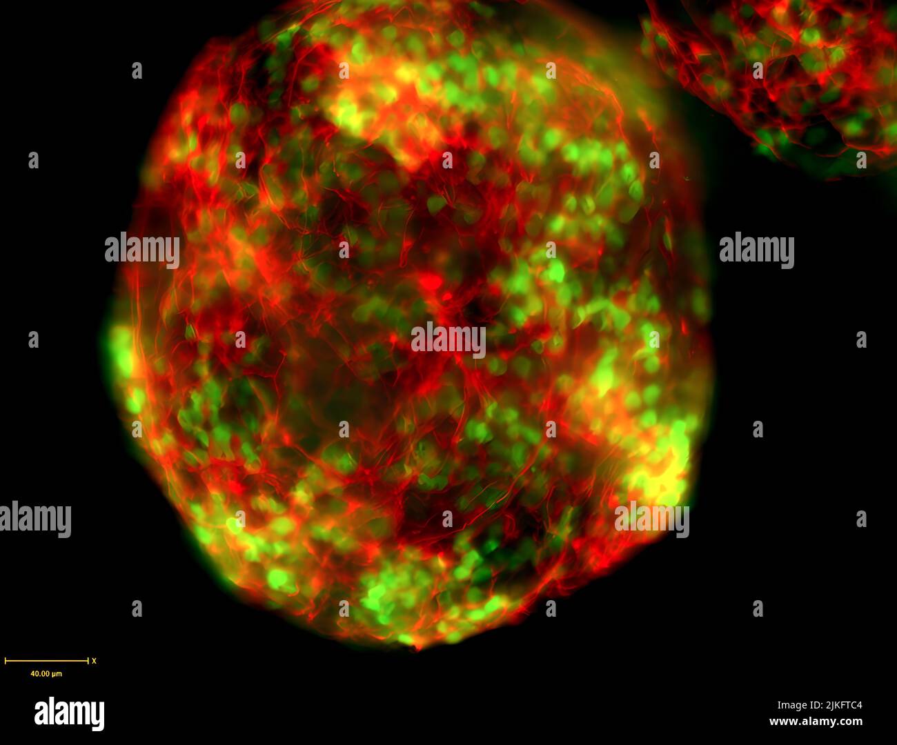 CRISPR/Cas9 engineering was used in mouse embryonic stem cells to insert an in-frame GFP tag with the motor neuron-specific transcription factor HB9. These cells are differentiated into motor neurons. The resulting motor neuron nuclei are labeled with the GFP reporter (green) and counterstained with antibodies against the neuronal marker Tuj1 (red). Stock Photo