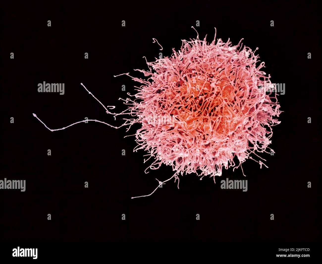 Colorized scanning electron micrograph of a natural killer cell from a human donor. Stock Photo