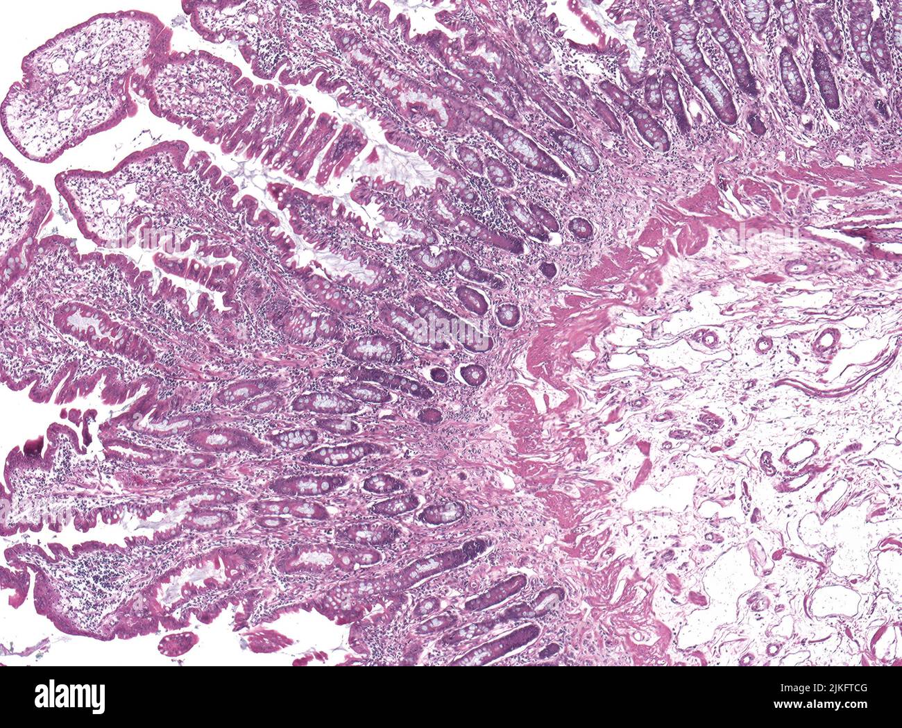 Lymphatic vessel microscope hires stock photography and images Alamy