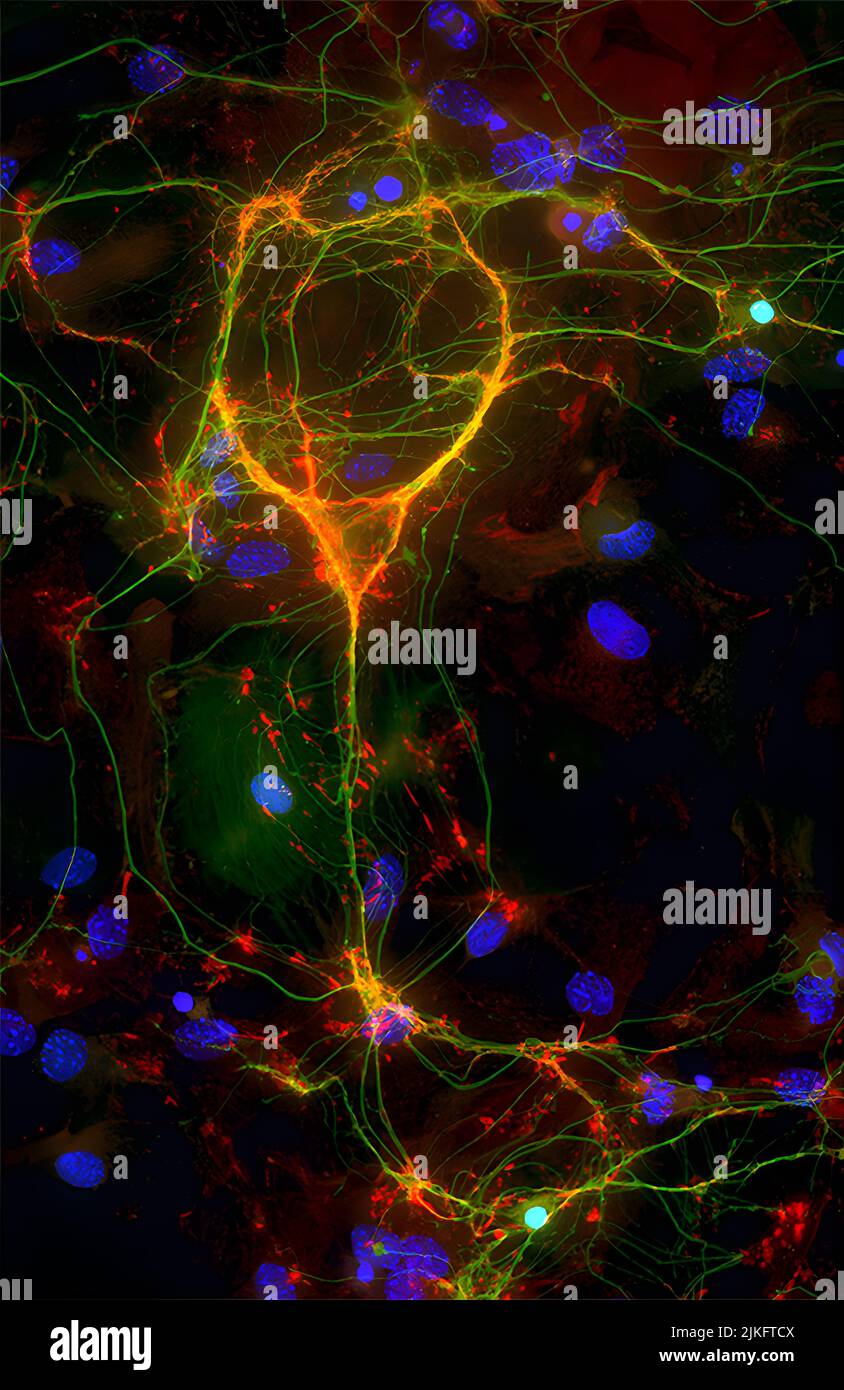A parvalbumin (green) containing an interneuron is stained for the glutamate receptor subunit GluA4 (red). Stock Photo