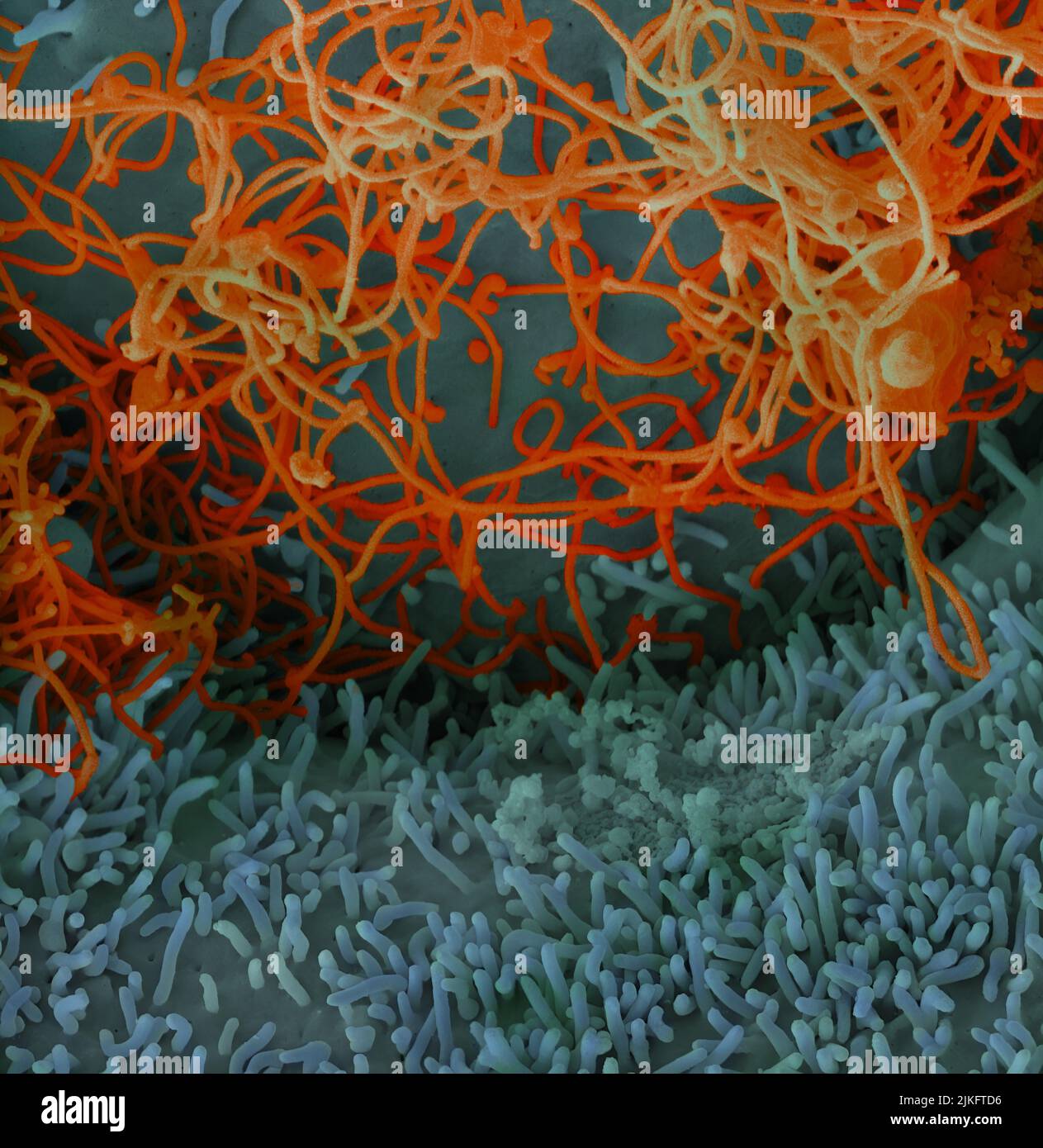 Ebola virus isolated in November 2014 from patient blood samples obtained in Mali. The virus was isolated on Vero cells. Stock Photo