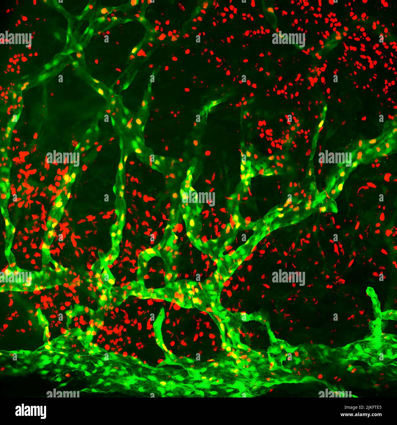The galectin-8 pellet was deployed in the cornea of a Prox1-EGFP reporter mouse. On day 7 after implantation, the corneal flat mount was stained with an anti-Ki67 antibody. About 40% of lymphatic endothelial cells were proliferative (Prox1+Ki67+). Green: Prox1. Red: Ki67. Related publication: Pathologic lymphangiogenesis is modulated by galectin-8-dependent crosstalk between podoplanin and integrin-associated VEGFR-3. Communication Nature, 2016. Stock Photo
