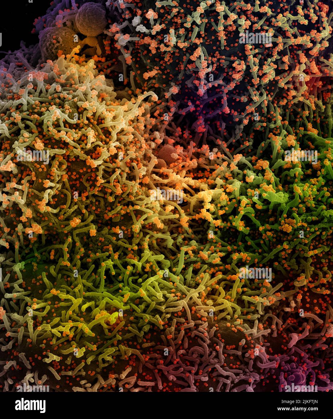 Scanning electron micrograph of a cell infected with a variant strain of SARS-CoV-2 virus particles (orange), isolated from a patient sample and colorized. Image requested from the NIAID Integrated Research Facility (IRF) in Fort Detrick, Maryland. Stock Photo