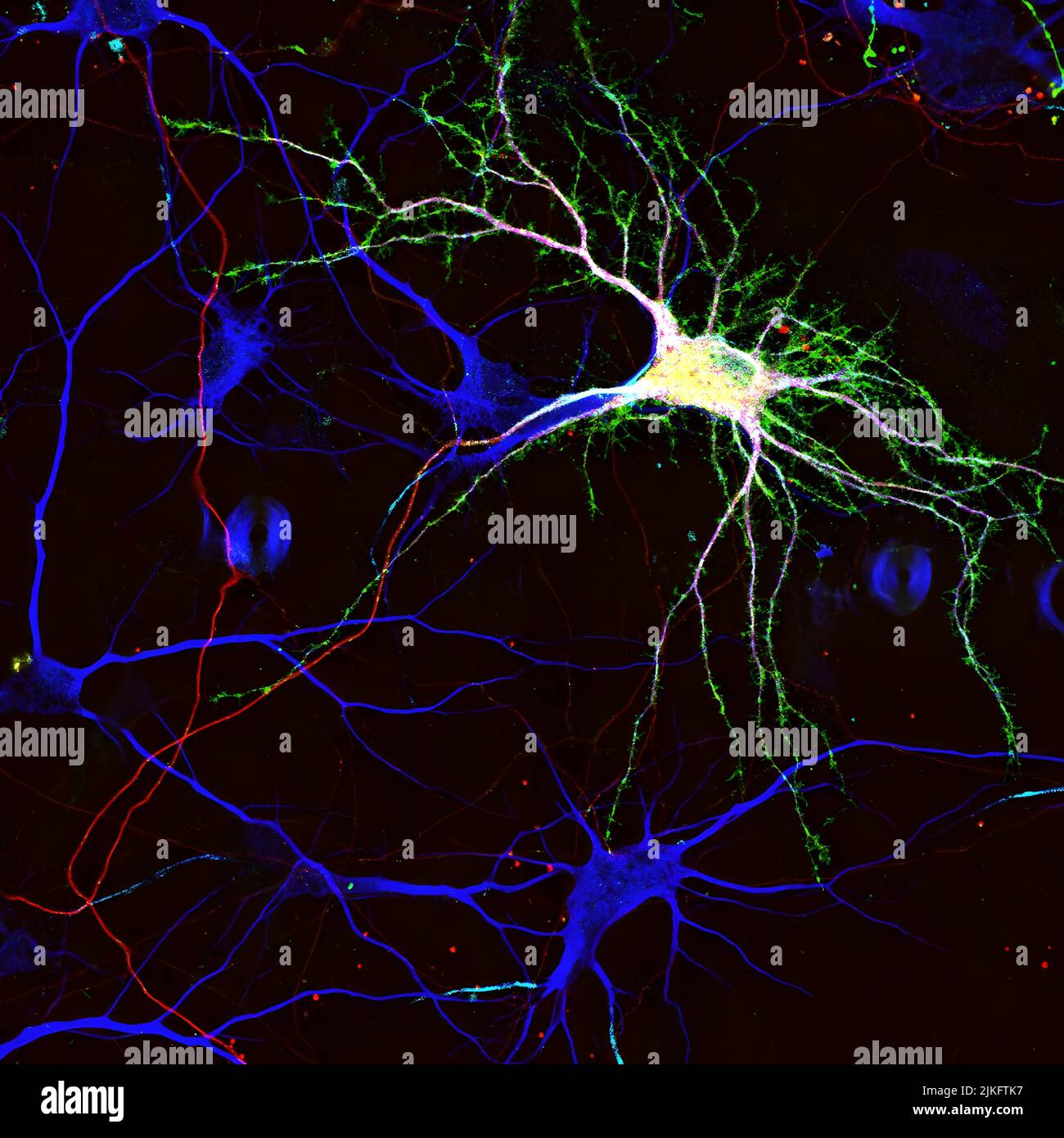 Nipah virus envelope glycoprotein F (NivF) is labeled green in hippocampal neurons. The dendrites are characterized in blue and the axon in red. Stock Photo