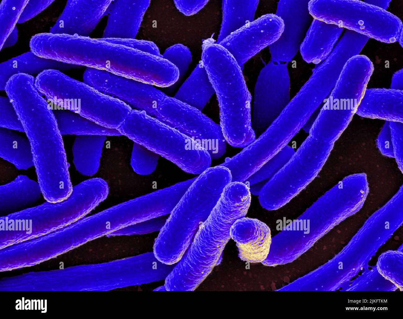 Scanning electron micrograph of Escherichia coli Stock Photo