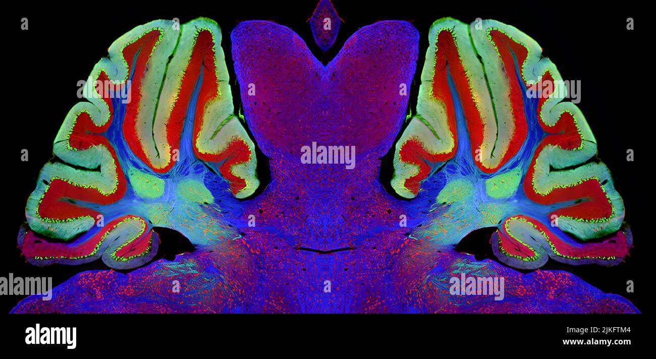Mirror image of a mouse brain with Niemann-Pick type C1 (NPC1) neurodegenerative disease. A major way to assess the impact of a therapeutic potential on the central nervous system is to assess cerebellar pathology in mice. Eunice Kennedy Shriver's National Institute of Child Health and Human Development (NICHD) researchers have found that an experimental drug can stabilize or slow the progression of NPC1. Stock Photo