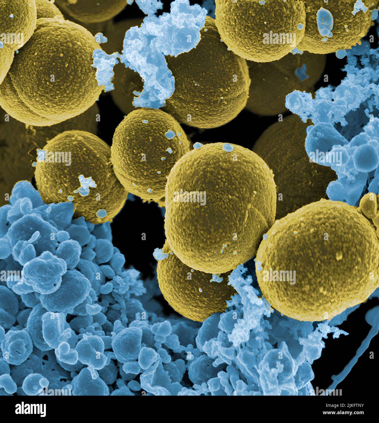 Scanning electron micrograph of S. aureus bacteria escaping destruction by human white blood cells. Stock Photo