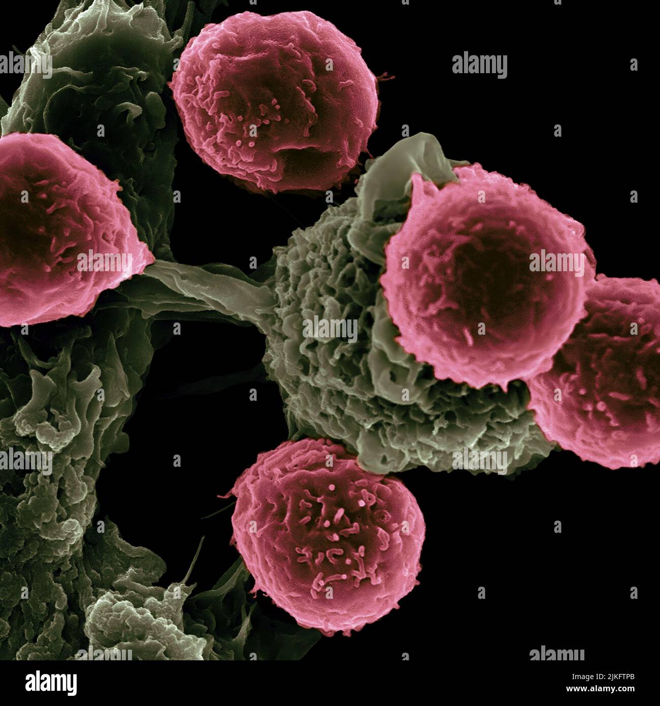 Researchers at the Texas Center for Cancer Nanomedicine (TCCN) have created particle-based vaccines for the treatment of cancer. The particles carry molecules that stimulate immune cells and cancer antigens (proteins) that direct the immune response. This scanning electron microscope image shows dendritic cells, pseudostained green, interacting with T cells, pseudostained pink. Dendritic cells internalize particles, provoke antigens and present peptides to T cells to direct immune responses. Stock Photo