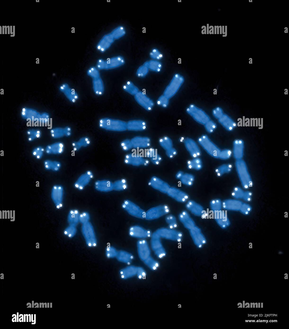 The 46 human chromosomes are shown in blue, with telomeres appearing as white dots. The DNA has already been copied, so each chromosome is actually made up of two identical lengths of DNA, each with its own two telomeres. Stock Photo