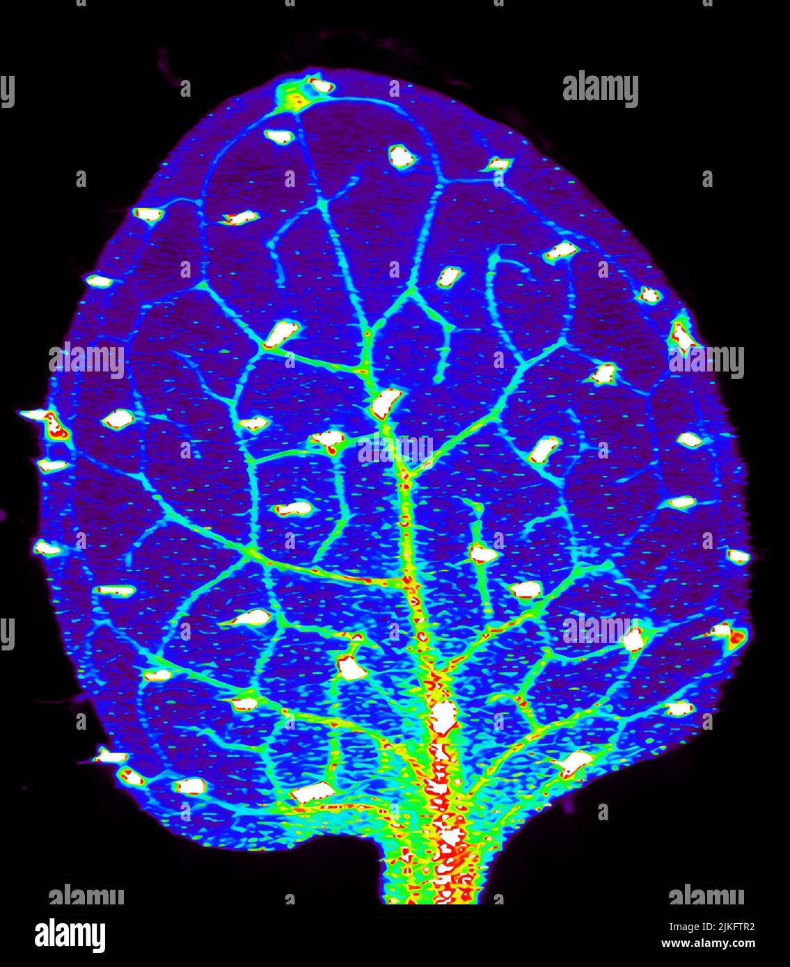 Zinc is necessary for the functioning of more than 300 enzymes, including those that help regulate gene expression, in various organisms, including humans. Researchers are studying how plants acquire, sequester and distribute zinc to find ways to increase the zinc content of crops to improve human health. Using synchrotron X-ray fluorescence technology, they created this heat map of zinc levels in an Arabidopsis thaliana plant leaf. Stock Photo