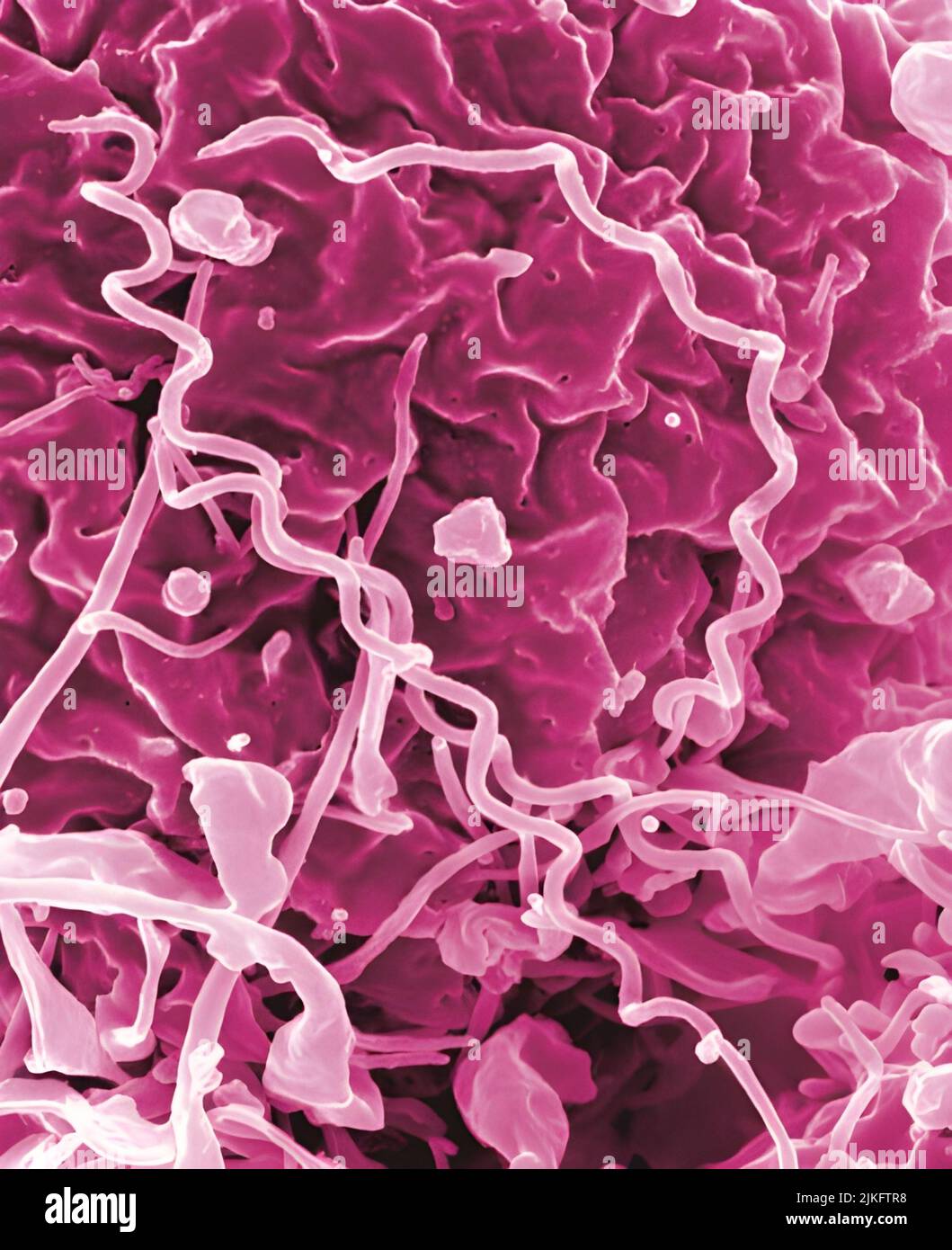 Treponema pallidum, the bacterium responsible for syphilis. Stock Photo