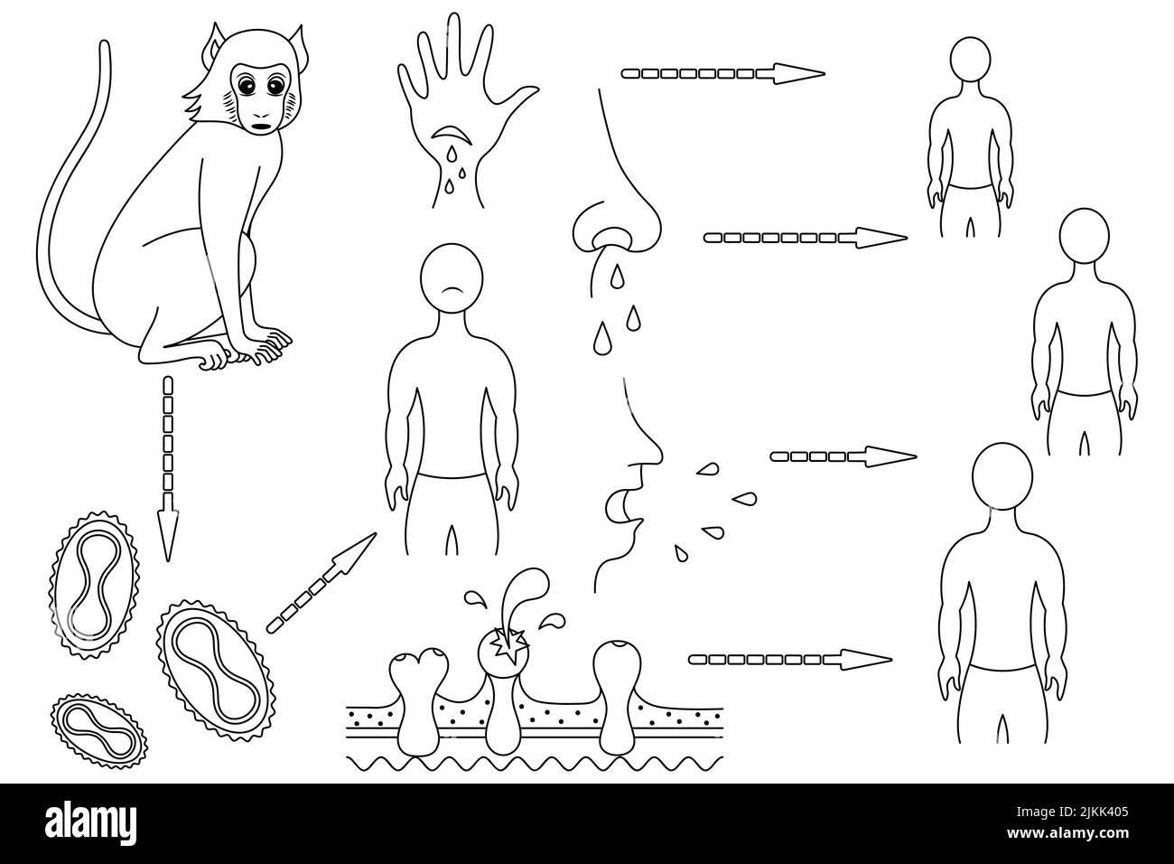 Monkeypox. The route of infection and the mechanism of transmission to humans of the smallpox virus. Sketch. Monkey - virus - man. Vector illustration Stock Vector