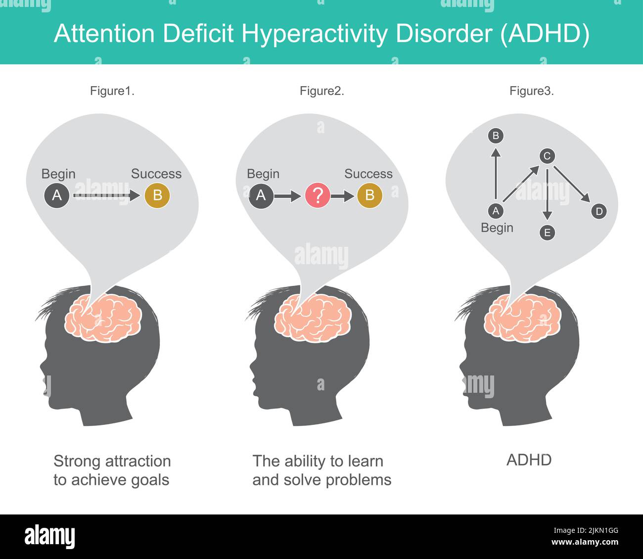 Attention deficit hyperactivity disorder. Explain ways of thinking and problem solving that happened to the brain of child. Stock Vector