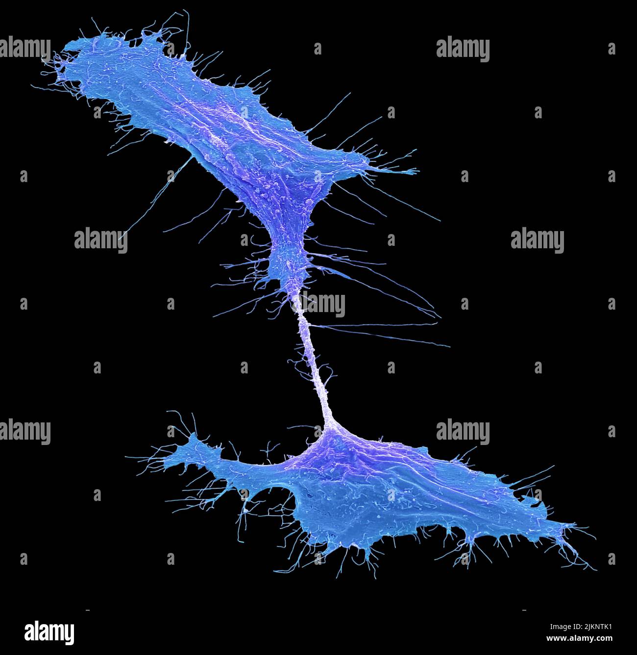 Human induced pluripotent cell, SEM Stock Photo - Alamy