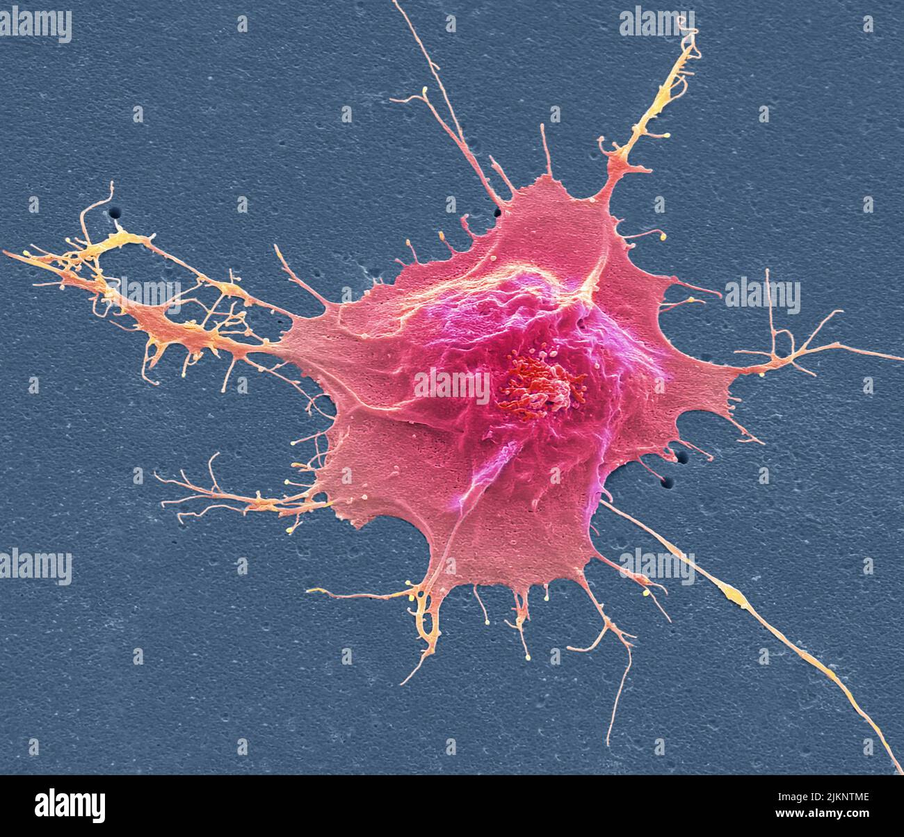 Human induced pluripotent cell, SEM Stock Photo - Alamy