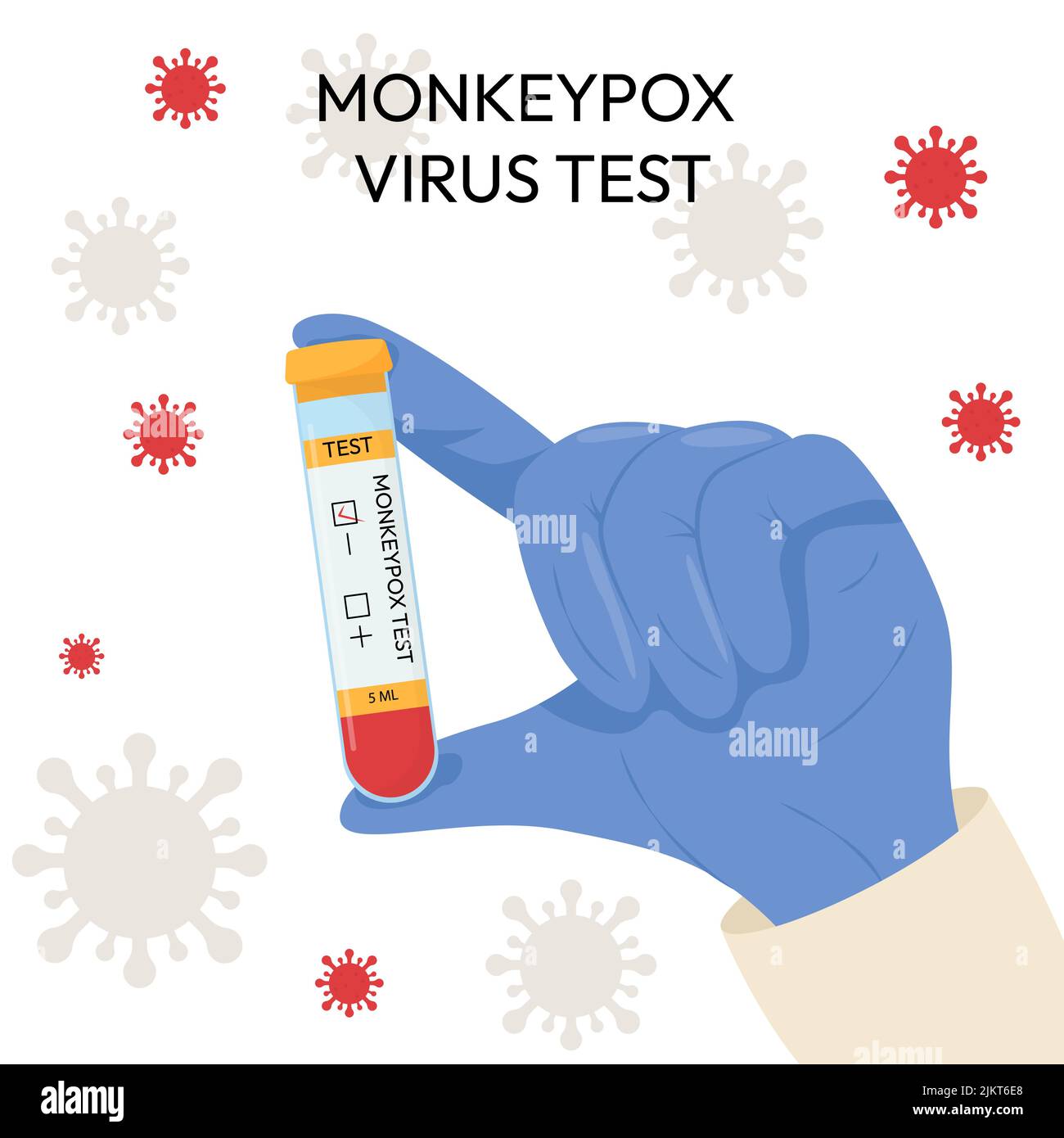 The hand of a doctor in a protective glove holds a test tube. Monkeypox ...