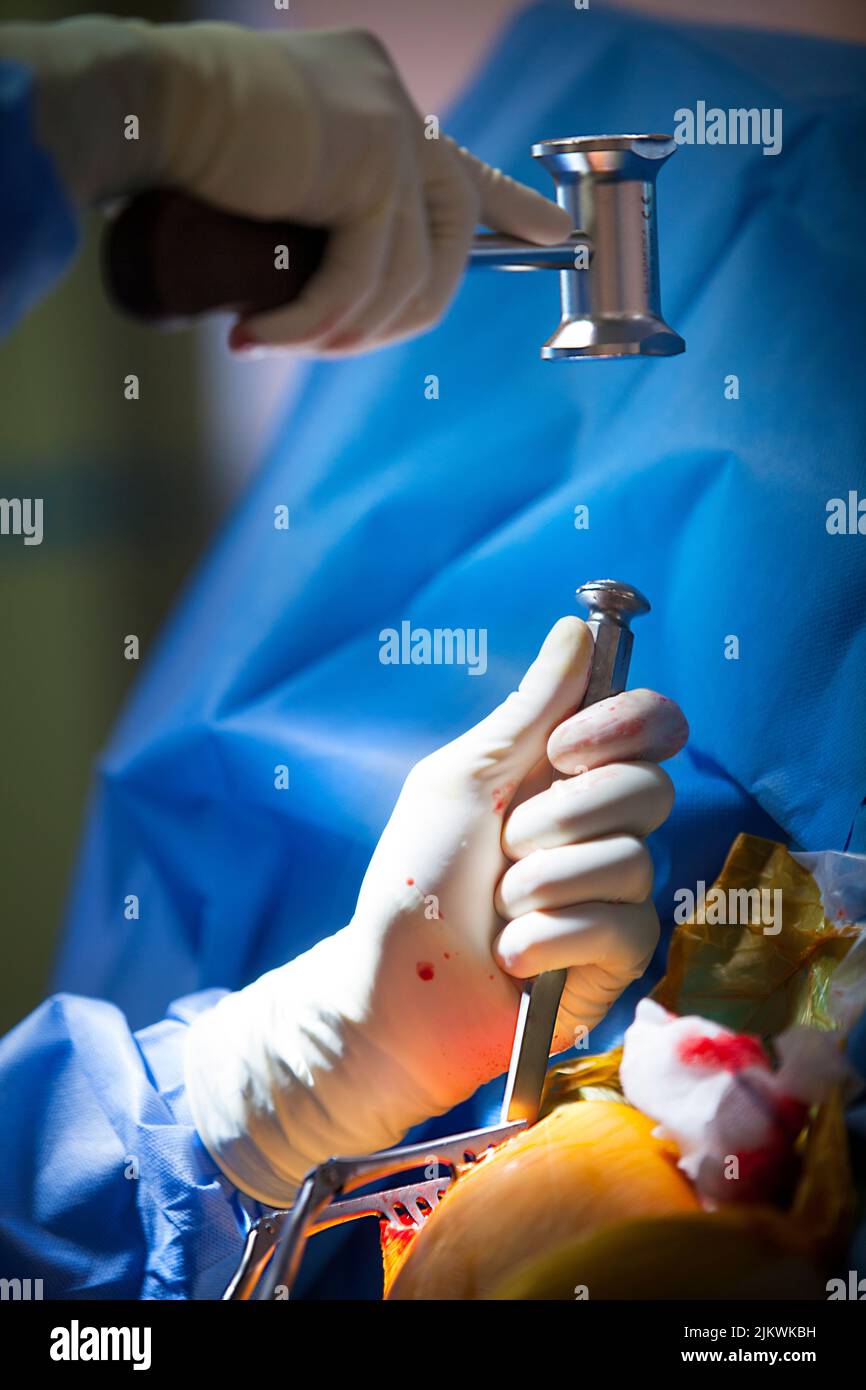 Orthopedic surgery operating room for acromioplasty and tenodesis of the biceps. Stock Photo