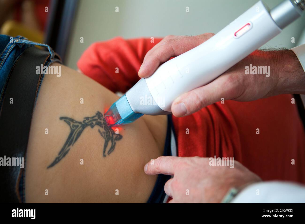 Fractional CO2 laser tattoo removal session in a beauty salon. Stock Photo