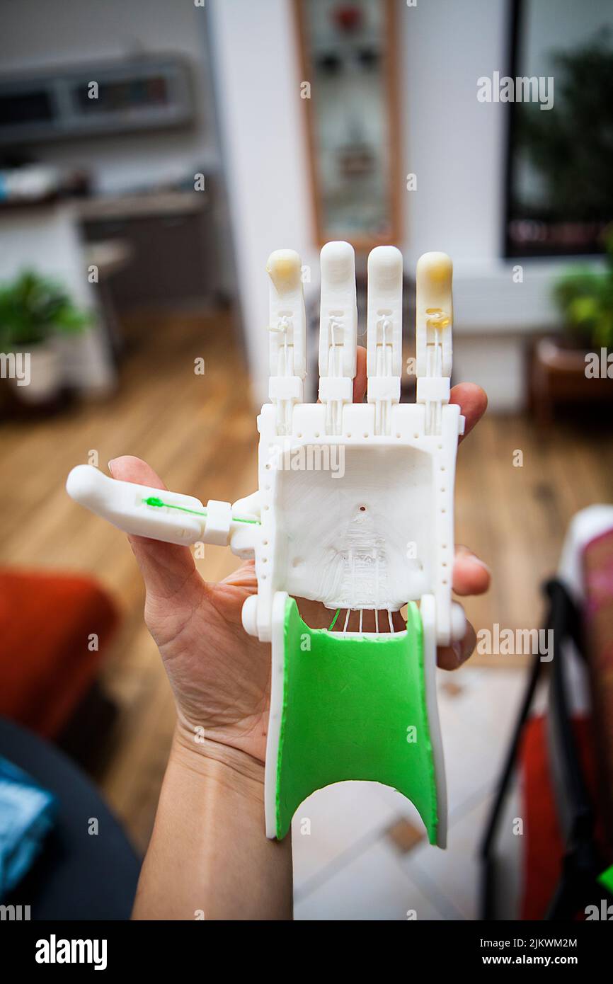 Manufacturing of a robotic hand in 3D printing for a disabled person
