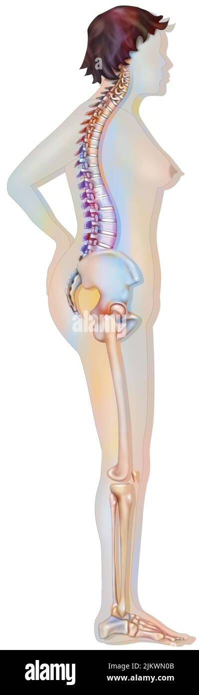 Bone system: silhouette of a 60-year-old woman with moderate osteoporosis. Stock Photo