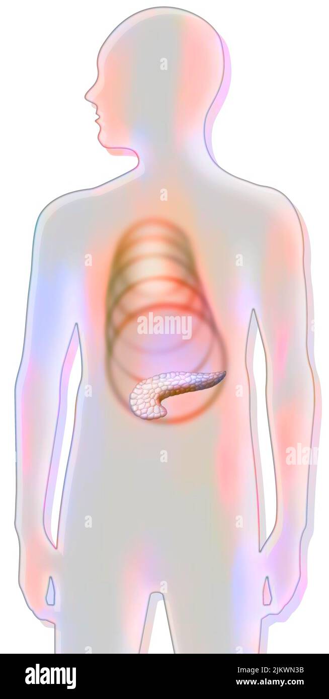 Pancreas: spread of pancreatic pain in the body. Stock Photo