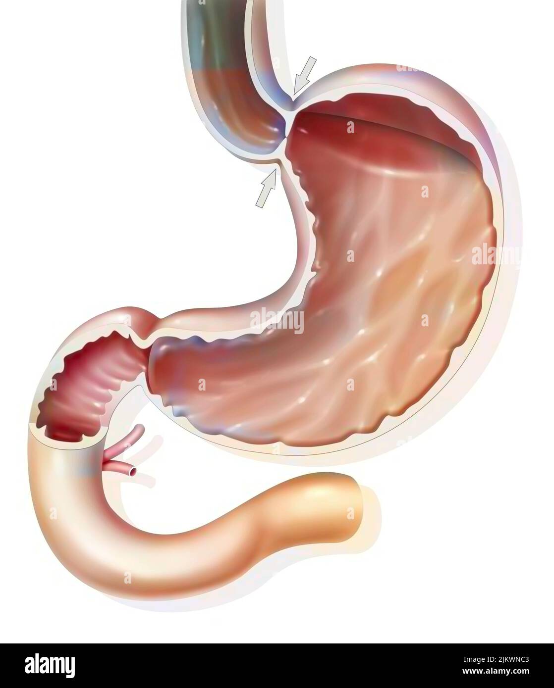 Stomach: normal, hermetic gastroesophageal sphincter, preventing gastroesophageal reflux. Stock Photo